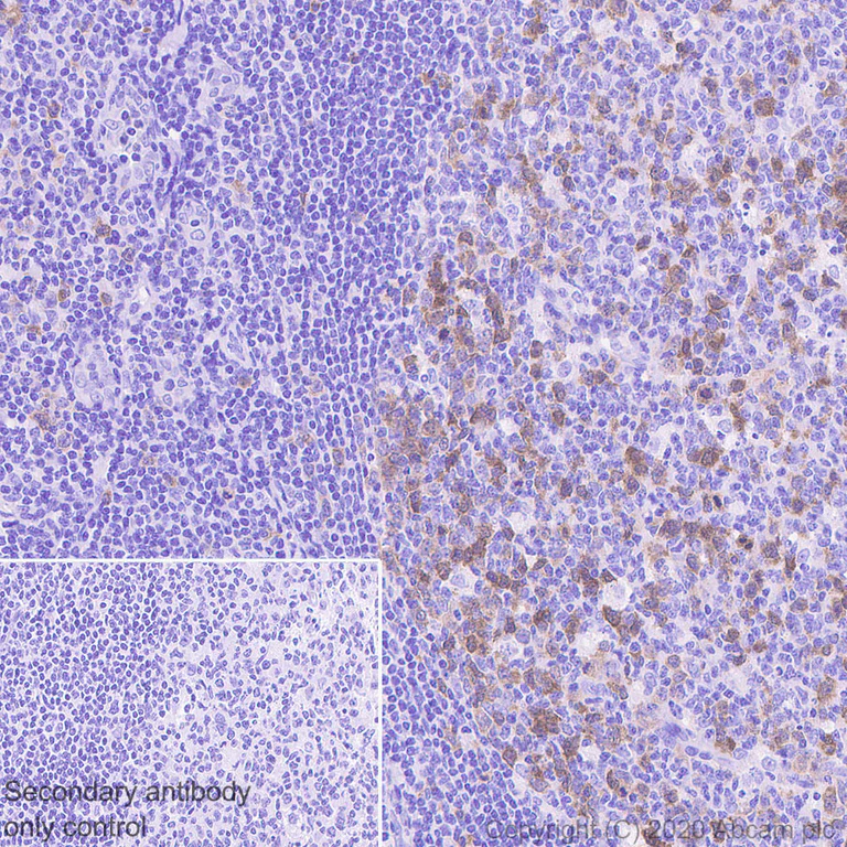 Immunohistochemistry (Formalin/PFA-fixed paraffin-embedded sections) - Anti-Thymidine Kinase 1/TK1 antibody [EPR3193] - BSA and Azide free (AB239885)