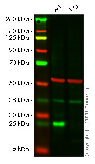 Western blot - Anti-Thymidine Kinase 1/TK1 antibody [EPR3193] - BSA and Azide free (AB239885), expandable thumbnail