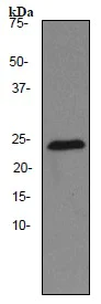 Western blot - Anti-Thymidine Kinase 1/TK1 antibody [EPR3194] (AB91651)