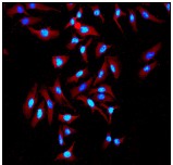 Immunocytochemistry/ Immunofluorescence - Anti-Thymidine Kinase 1/TK1 antibody [EPR3194] - BSA and Azide free (AB223164), expandable thumbnail