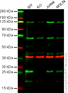 Western blot - Anti-Thymidine Kinase 1/TK1 antibody [EPR3194] - BSA and Azide free (AB223164)
