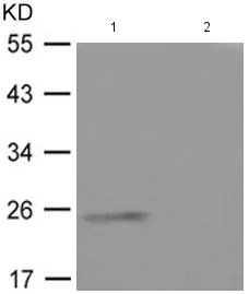 Western blot - Anti-Thymidine Kinase 1/TK1 (phospho S13) antibody (AB182610)
