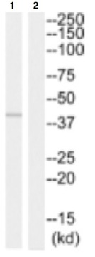 Western blot - Anti-Thymidine Kinase HHV1 antibody (AB129880)