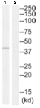 Western blot - Anti-Thymidine Kinase HHV1 antibody (AB129880)