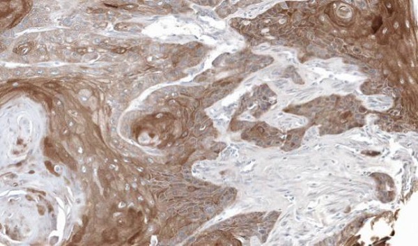Immunohistochemistry (Formalin/PFA-fixed paraffin-embedded sections) - Anti-Thymidine Phosphorylase antibody (AB226917)