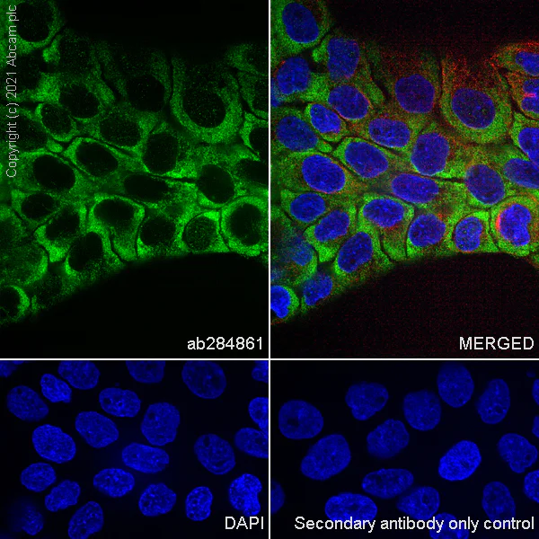 Immunocytochemistry/ Immunofluorescence - Anti-Thymidine Phosphorylase antibody [EPR25629-129] (AB284861)