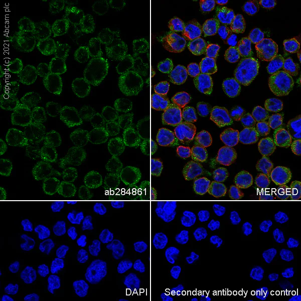 Immunocytochemistry/ Immunofluorescence - Anti-Thymidine Phosphorylase antibody [EPR25629-129] (AB284861)