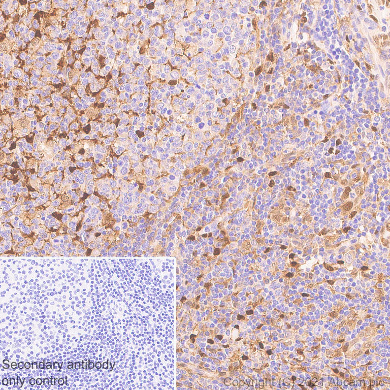 Immunohistochemistry (Formalin/PFA-fixed paraffin-embedded sections) - Anti-Thymidine Phosphorylase antibody [EPR25629-129] (AB284861)