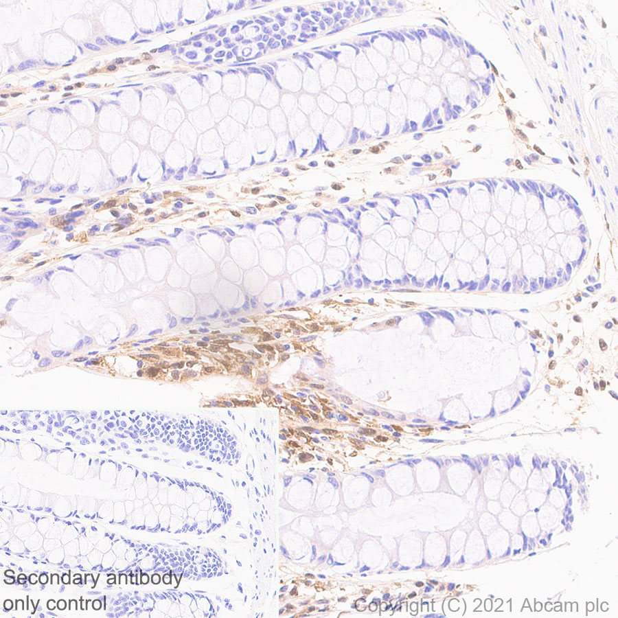 Immunohistochemistry (Formalin/PFA-fixed paraffin-embedded sections) - Anti-Thymidine Phosphorylase antibody [EPR25629-129] (AB284861)