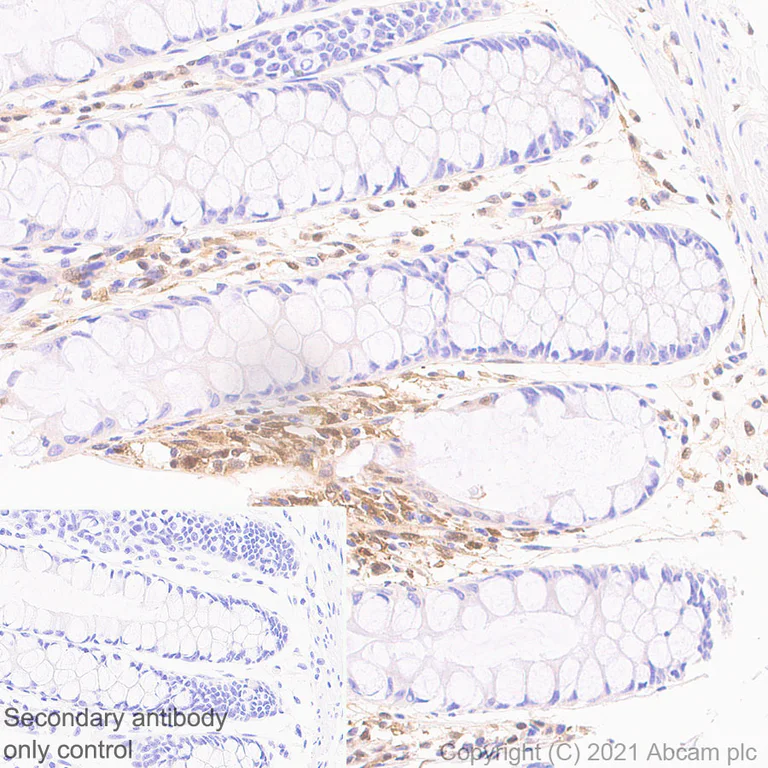 Immunohistochemistry (Formalin/PFA-fixed paraffin-embedded sections) - Anti-Thymidine Phosphorylase antibody [EPR25629-129] (AB284861)