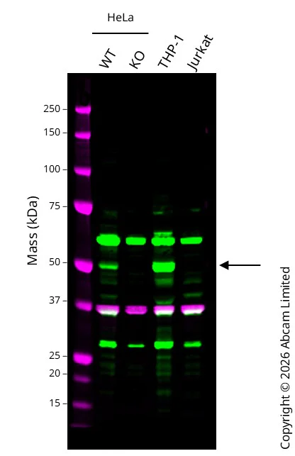 Western blot - Anti-Thymidine Phosphorylase antibody [EPR25629-129] (AB284861)