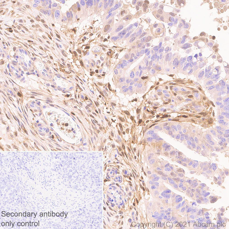 Immunohistochemistry (Formalin/PFA-fixed paraffin-embedded sections) - Anti-Thymidine Phosphorylase antibody [EPR25629-129] - BSA and Azide free (AB284863)