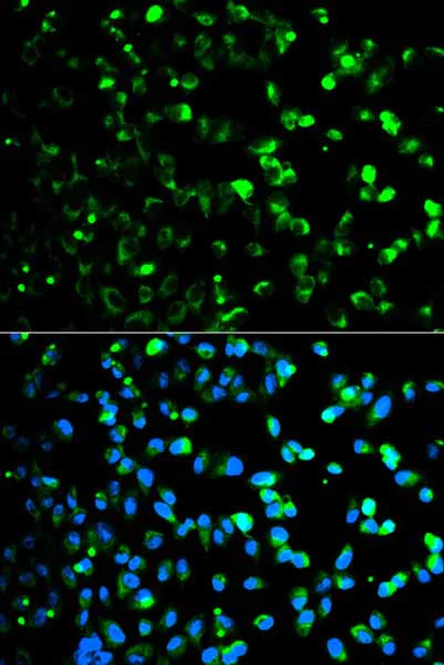 Immunocytochemistry/ Immunofluorescence - Anti-Thymidine Phosphorylase antibody - N-terminal (AB180783)