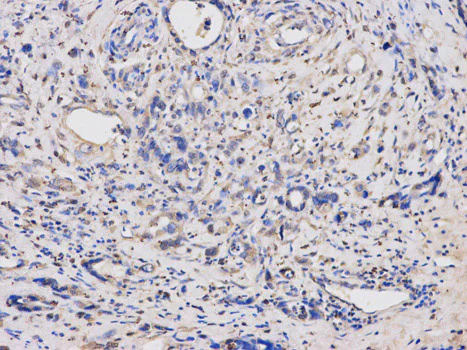 Immunohistochemistry (Formalin/PFA-fixed paraffin-embedded sections) - Anti-Thymidine Phosphorylase antibody - N-terminal (AB180783)