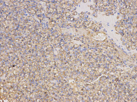 Immunohistochemistry (Formalin/PFA-fixed paraffin-embedded sections) - Anti-Thymidine Phosphorylase antibody - N-terminal (AB180783)