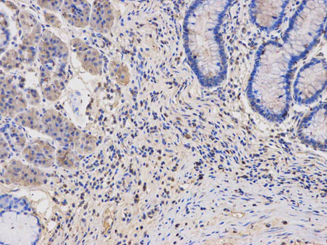 Immunohistochemistry (Formalin/PFA-fixed paraffin-embedded sections) - Anti-Thymidine Phosphorylase antibody - N-terminal (AB180783)