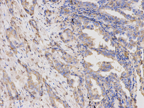 Immunohistochemistry (Formalin/PFA-fixed paraffin-embedded sections) - Anti-Thymidine Phosphorylase antibody - N-terminal (AB180783)