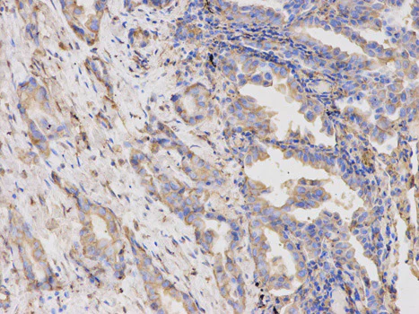 Immunohistochemistry (Formalin/PFA-fixed paraffin-embedded sections) - Anti-Thymidine Phosphorylase antibody - N-terminal (AB180783)