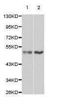 Western blot - Anti-Thymidine Phosphorylase antibody - N-terminal (AB180783)
