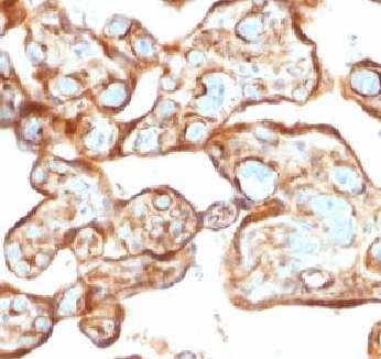 Immunohistochemistry (Formalin/PFA-fixed paraffin-embedded sections) - Anti-Thymidine Phosphorylase antibody [P-GF.44C] (AB218381)