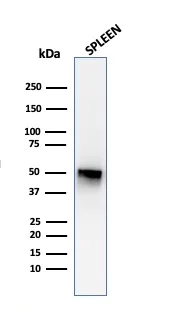 Western blot - Anti-Thymidine Phosphorylase antibody [P-GF.44C] (AB218381)