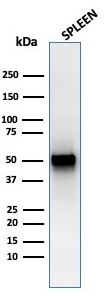 Western blot - Anti-Thymidine Phosphorylase antibody [rTYMP/3444] (AB270728), expandable thumbnail