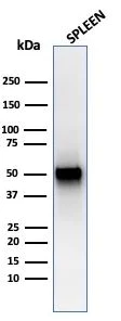 Western blot - Anti-Thymidine Phosphorylase antibody [rTYMP/3444] (AB270728)
