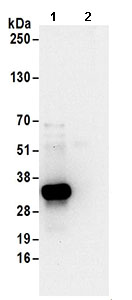 Immunoprecipitation - Anti-Thymidylate Synthase antibody (AB168853)