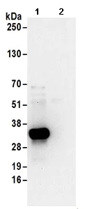 Immunoprecipitation - Anti-Thymidylate Synthase antibody (AB168853)