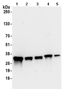 Western blot - Anti-Thymidylate Synthase antibody (AB168853)
