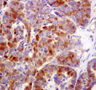 Immunohistochemistry (Formalin/PFA-fixed paraffin-embedded sections) - Anti-Thymidylate Synthase antibody [EPR4545] - BSA and Azide free (AB232021)