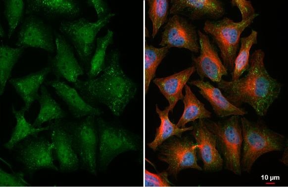 Immunocytochemistry/ Immunofluorescence - Anti-Thymidylate synthase antibody [HL1236] (ab308383), expandable thumbnail