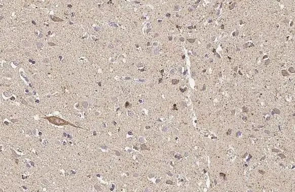 Immunohistochemistry (Formalin/PFA-fixed paraffin-embedded sections) - Anti-Thymidylate synthase antibody [HL1236] (AB308383), expandable thumbnail