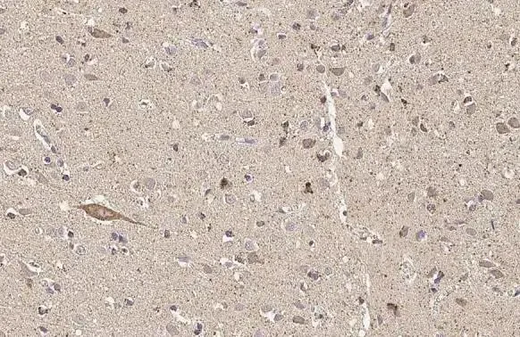 Immunohistochemistry (Formalin/PFA-fixed paraffin-embedded sections) - Anti-Thymidylate synthase antibody [HL1236] (AB308383)