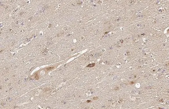 Immunohistochemistry (Formalin/PFA-fixed paraffin-embedded sections) - Anti-Thymidylate synthase antibody [HL1236] (AB308383), expandable thumbnail