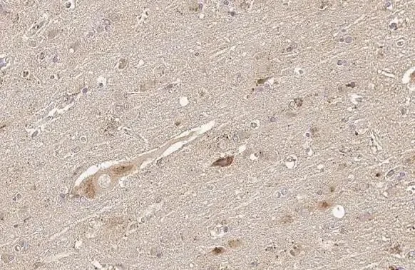 Immunohistochemistry (Formalin/PFA-fixed paraffin-embedded sections) - Anti-Thymidylate synthase antibody [HL1236] (AB308383)