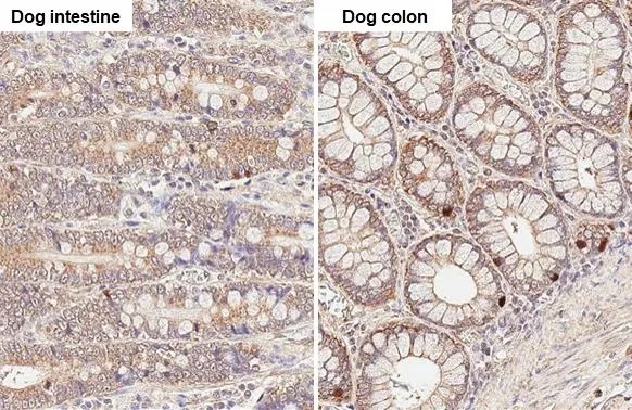 Immunohistochemistry (Formalin/PFA-fixed paraffin-embedded sections) - Anti-Thymidylate synthase antibody [HL1236] (AB308383), expandable thumbnail