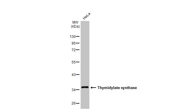 Western blot - Anti-Thymidylate synthase antibody [HL1236] (AB308383), expandable thumbnail