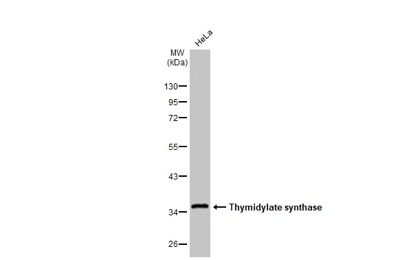 Western blot - Anti-Thymidylate synthase antibody [HL1236] (AB308383)