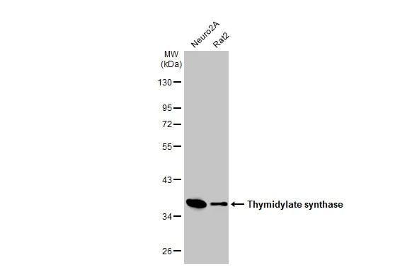 Western blot - Anti-Thymidylate synthase antibody [HL1236] (AB308383)