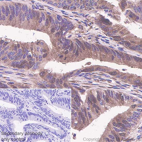 Immunohistochemistry (Formalin/PFA-fixed paraffin-embedded sections) - Anti-Thymidylate Synthase antibody [SP112] (AB111153), expandable thumbnail