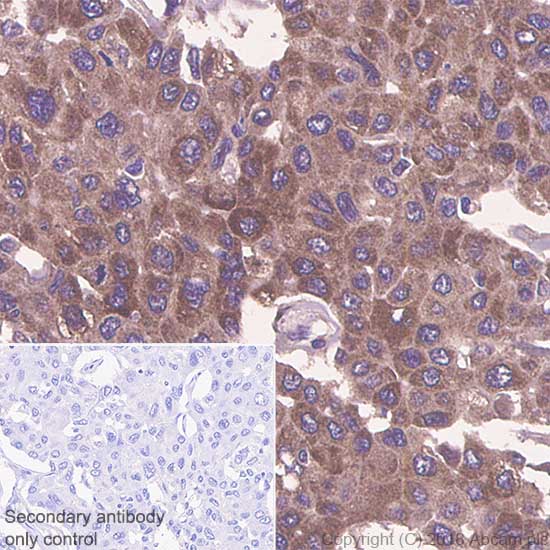 Immunohistochemistry (Formalin/PFA-fixed paraffin-embedded sections) - Anti-Thymidylate Synthase antibody [SP112] (AB111153), expandable thumbnail