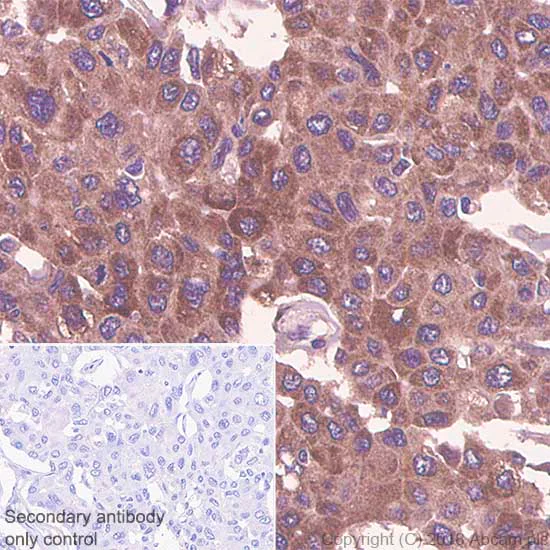 Immunohistochemistry (Formalin/PFA-fixed paraffin-embedded sections) - Anti-Thymidylate Synthase antibody [SP112] (AB111153)