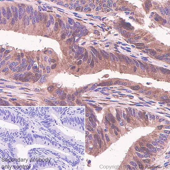 Immunohistochemistry (Formalin/PFA-fixed paraffin-embedded sections) - Anti-Thymidylate Synthase antibody [SP112] - BSA and Azide free (AB240947)