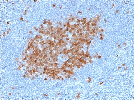 Immunohistochemistry (Formalin/PFA-fixed paraffin-embedded sections) - Anti-Thymidylate Synthase antibody [TYMS/1884] (AB224649), expandable thumbnail