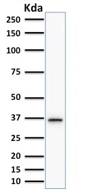 Western blot - Anti-Thymidylate Synthase antibody [TYMS/1884] (AB224649), expandable thumbnail