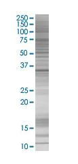 SDS-PAGE - Thymidylate Synthase overexpression 293T lysate (whole cell) (AB94158)