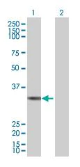 Western blot - Thymidylate Synthase overexpression 293T lysate (whole cell) (AB94158)