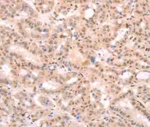 Immunohistochemistry (Formalin/PFA-fixed paraffin-embedded sections) - Anti-Thymosin alpha 1 antibody - N-terminal (AB198880)