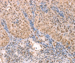 Immunohistochemistry (Formalin/PFA-fixed paraffin-embedded sections) - Anti-Thymosin alpha 1 antibody - N-terminal (AB198880)